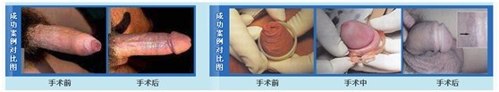 玉溪长庚医院