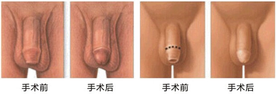 玉溪长庚医院