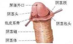 男性包皮系带过短图片是什么样的